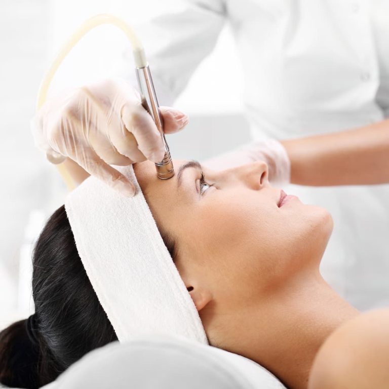DermaSweep Microdermabrasion - Professional skin exfoliation with serum infusion